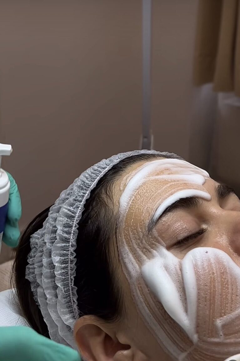 facial skin glow treatment bucharest